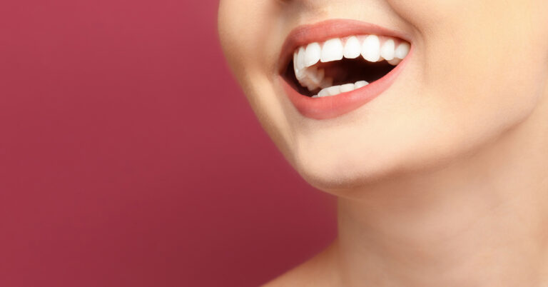 clareamento dental em campina grande